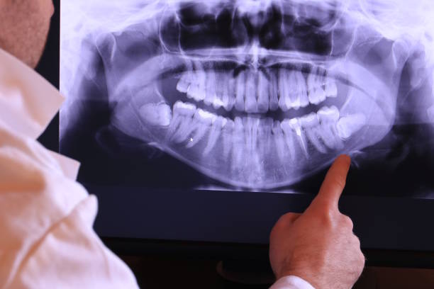 Best Emergency Dental Extractions in West Point, VA