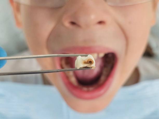 Best Emergency Dental Services for Seniors in West Point, VA